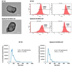 [고분자약물전달실험실] 지방 유래 중간엽 줄기세포와 섬유아세포 유래 세포외 소포 비교