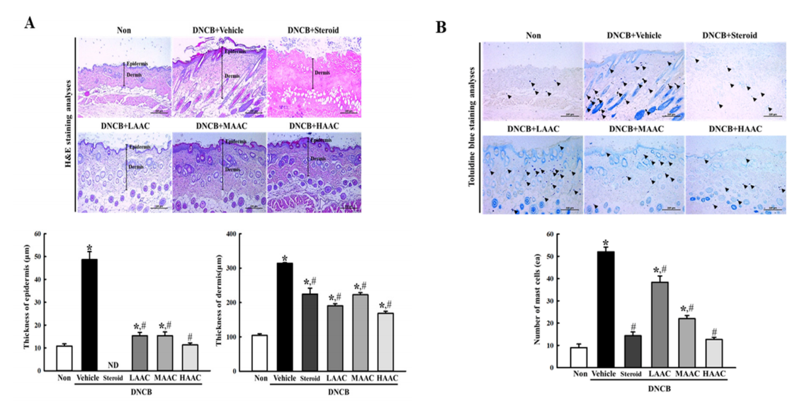 [분자생물실험실] 새로운 아토피질환 치료제 개발