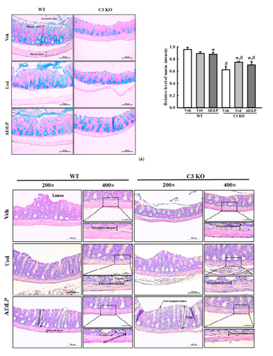 [분자생물실험실] 보체단백질 결핍에 의해 유발되는 변비의 새로운 치료제 개발