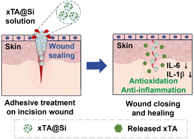항염증 실리카 접착제 개발